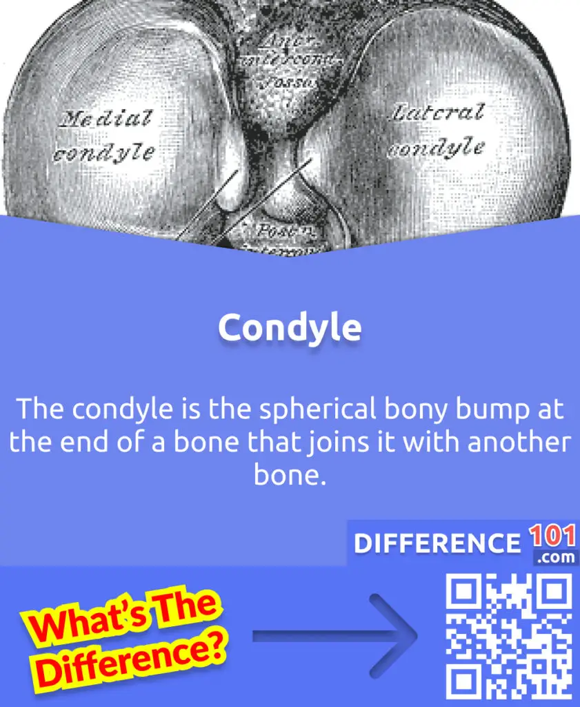 What is Condyle? The condyle is the spherical bony bump at the end of a bone that joins it with another bone.
