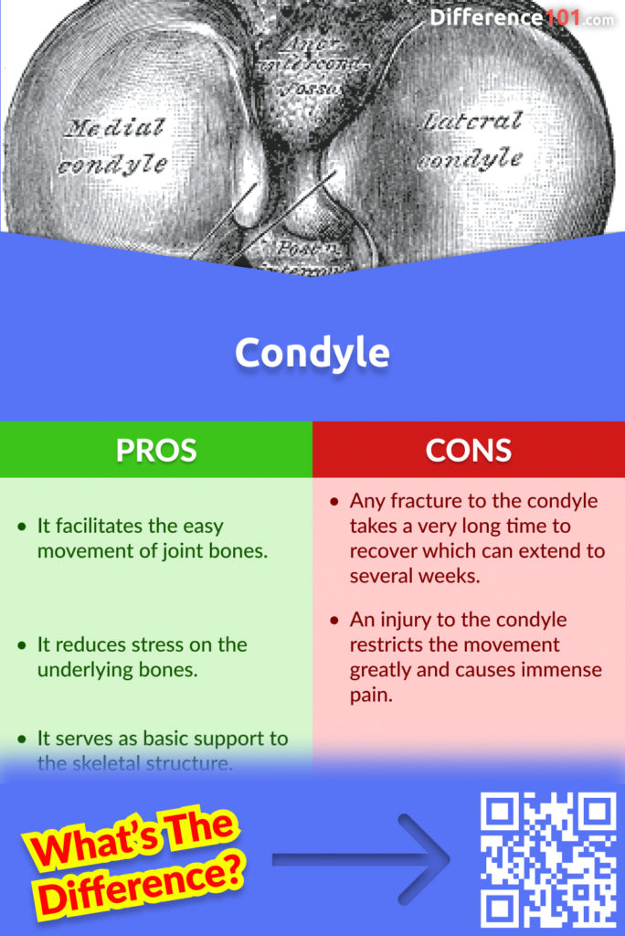 Condyle Pros and Cons