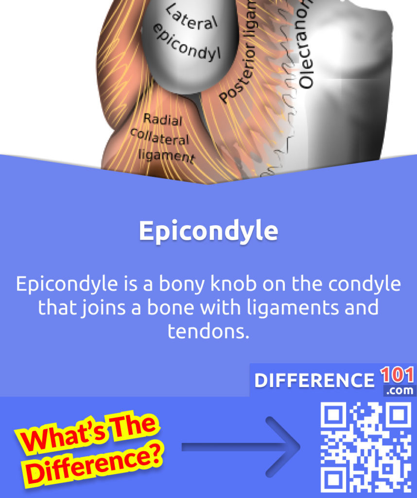 What is Epicondyle? Epicondyle is a bony knob on the condyle that joins a bone with ligaments and tendons.