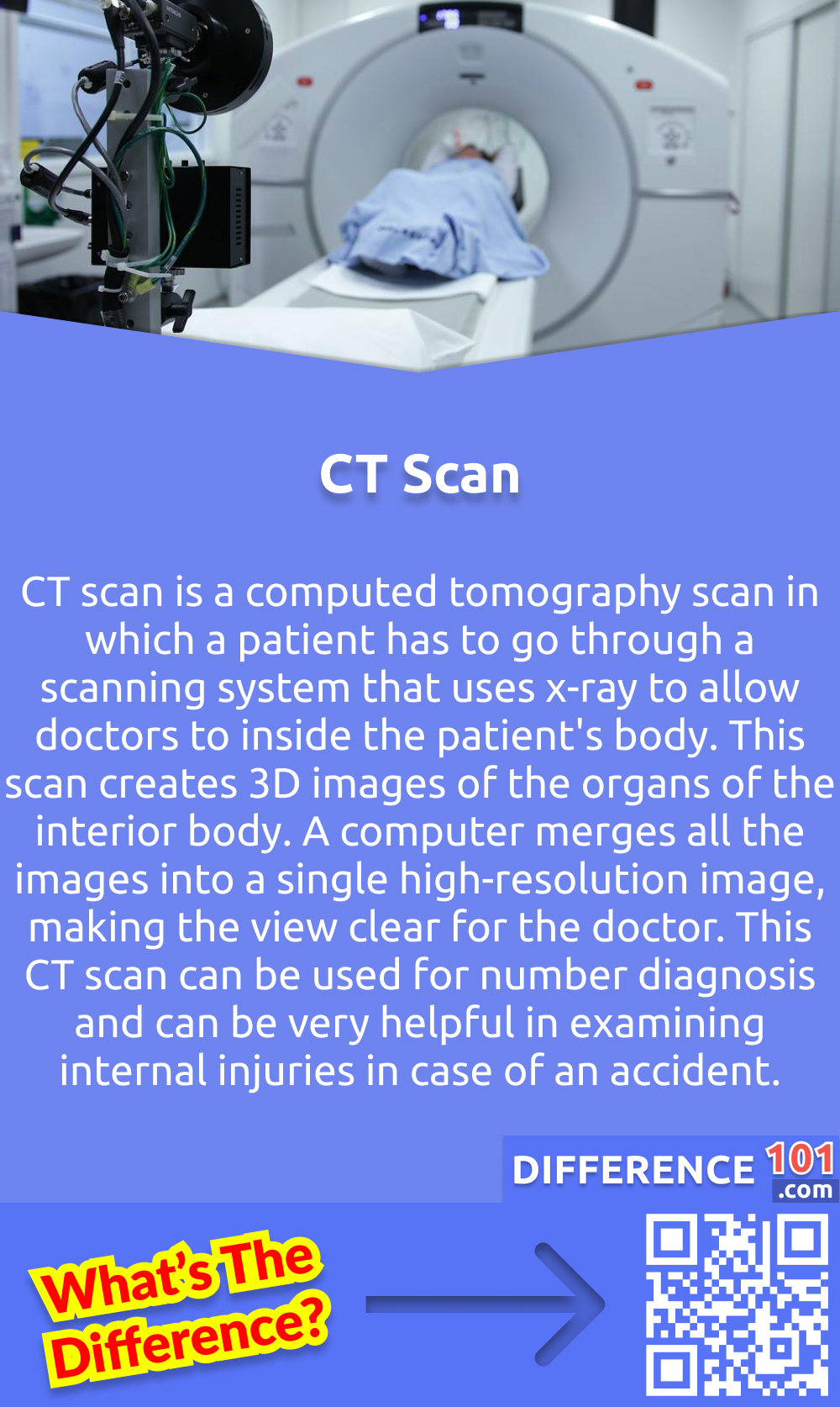 What is CT Scan? CT scan is a computed tomography scan in which a patient has to go through a scanning system that uses x-ray to allow doctors to inside the patient's body. This scan creates 3D images of the organs of the interior body. A computer merges all the images into a single high-resolution image, making the view clear for the doctor. This CT scan can be used for number diagnosis and can be very helpful in examining internal injuries in case of an accident.
