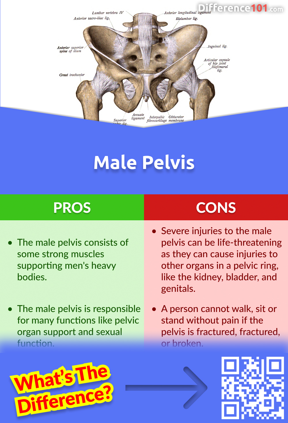 Male Pelvis Pros and Cons