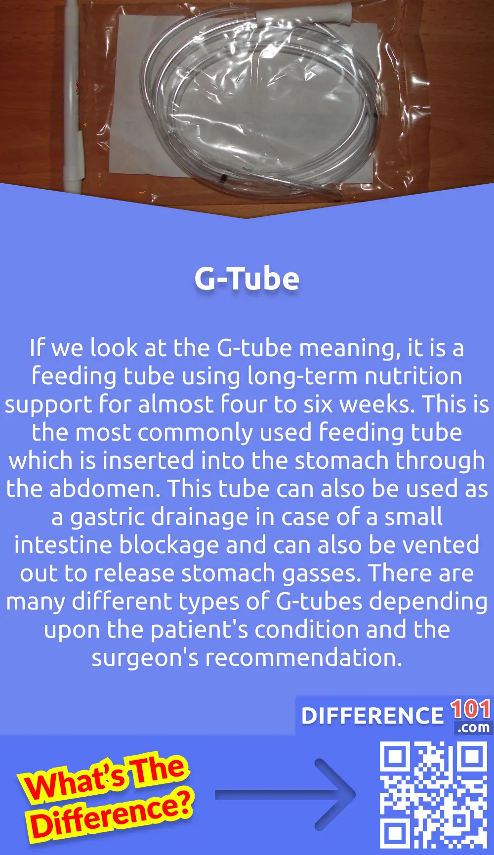 What Is G-Tube? If we look at the G-tube meaning, it is a feeding tube using long-term nutrition support for almost four to six weeks. This is the most commonly used feeding tube which is inserted into the stomach through the abdomen. This tube can also be used as a gastric drainage in case of a small intestine blockage and can also be vented out to release stomach gasses. G-tube is inserted into the stomach with the help of three different surgeries. The first one is by creating an inside opening via scope. The second one is by a small incision, with the help of a laparoscope. And the last one is through a large incision. The best thing about G-tubes is that they can be easily changed at home as there is not any complicated procedure to change these. There are many different types of G-tubes depending upon the patient's condition and the surgeon's recommendation.
