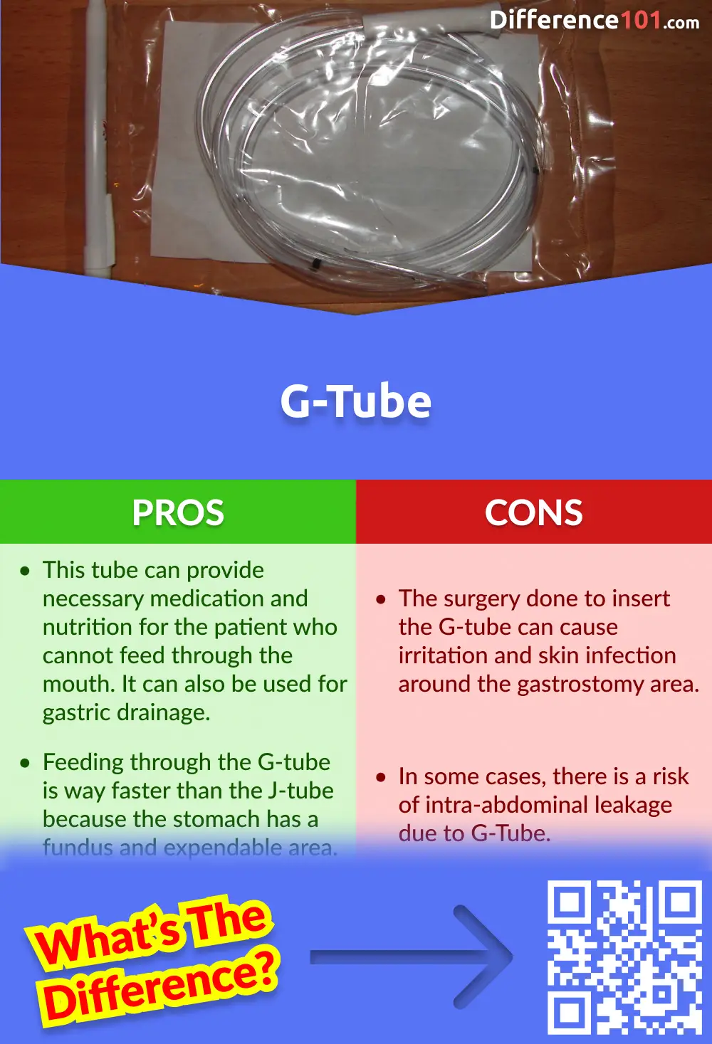 G-tube Pros and Cons
