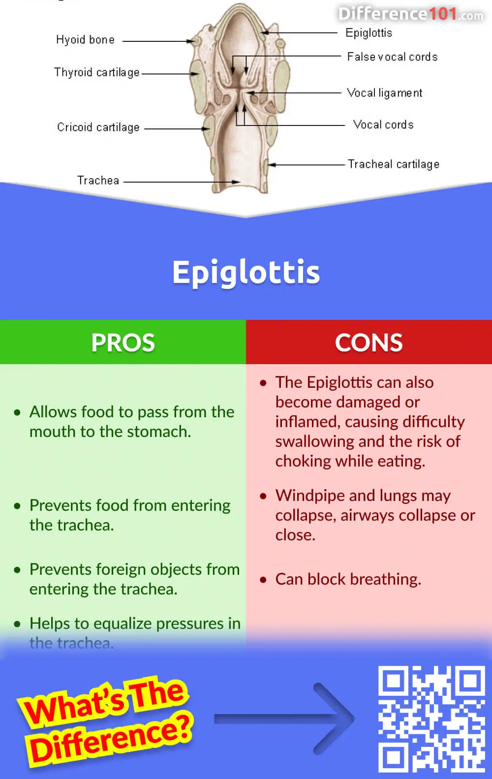 Epiglottis Pros & Cons
