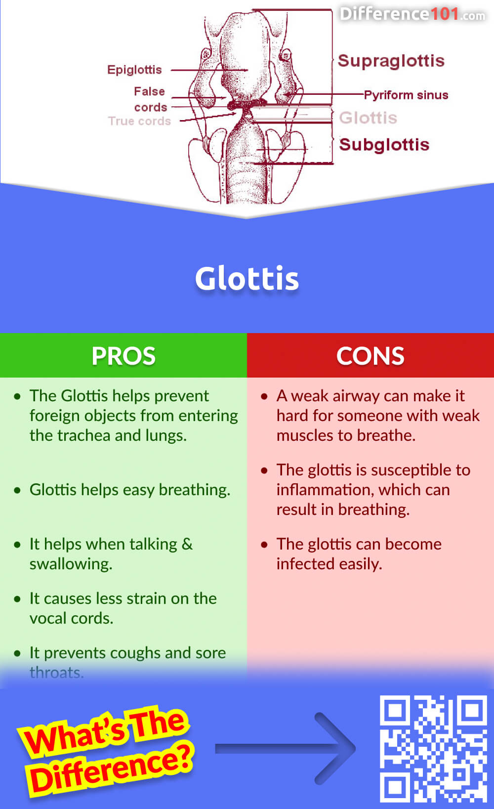 Glottis Pros & Cons