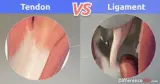 Tendon vs. Ligament: What is the difference between Tendon and Ligament?